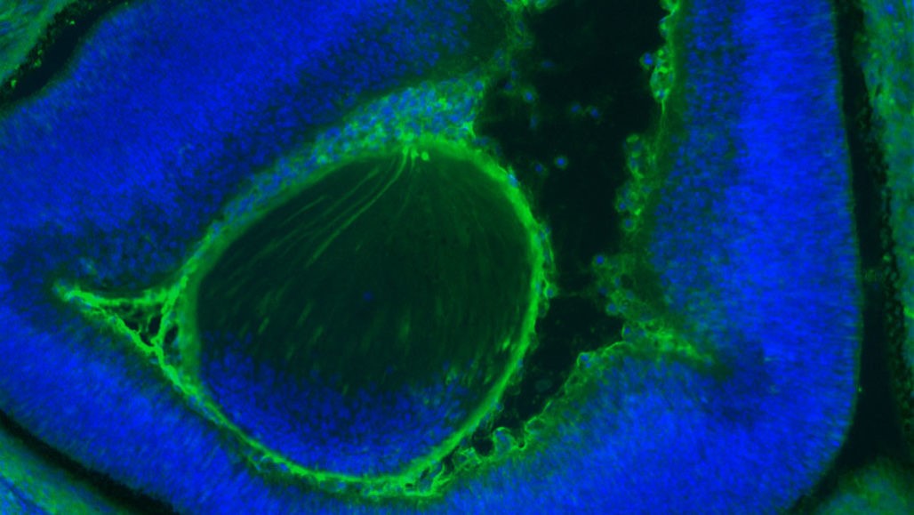 人類細胞（綠色）聚集在發育中的老鼠眼睛（藍色）中。